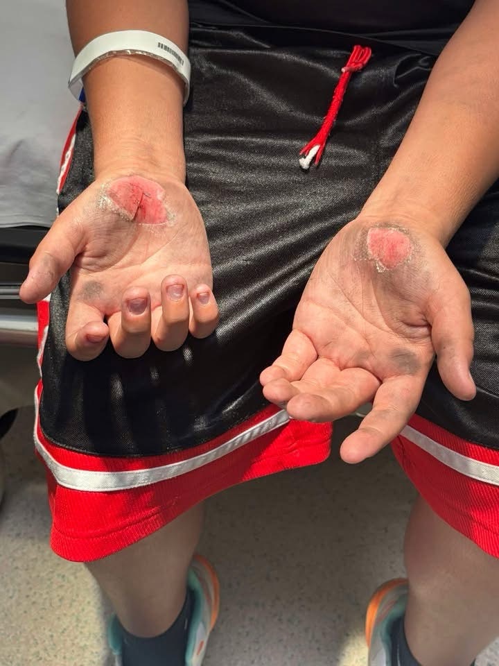 GRAPHIC IMAGES: Injuries to Woodville ISD Students Reveal Severity of Track Incident